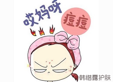 快速祛痘的方法有哪些？