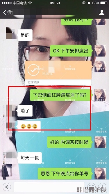膿包結節發硬痘痘全消了，帥哥開心的來反饋了！